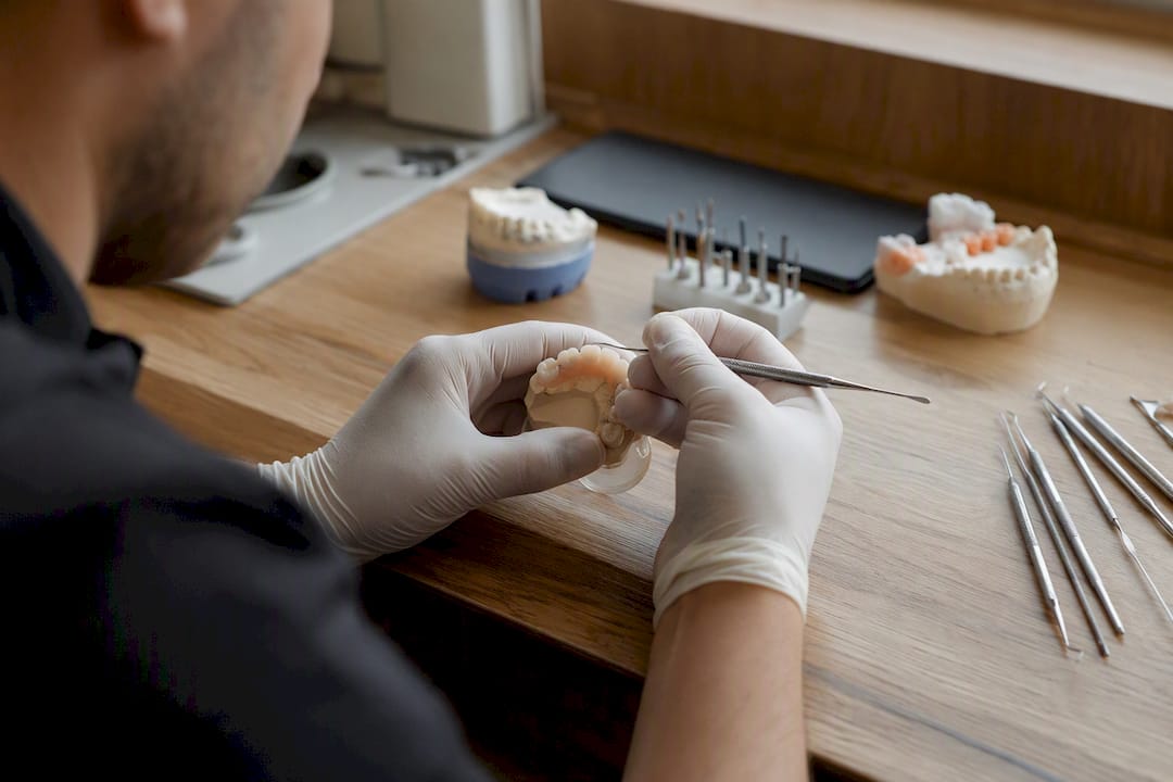 Mâini pregătind o amprentă dentară pentru designul zâmbetului