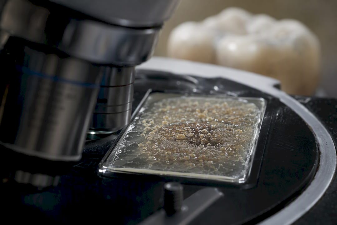 Vedere macro a structurii biofilmului dentar pe smalț
